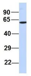 Anti-PRMT7 antibody, N-term used in Western Blot (WB). GTX47432
