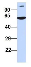 Anti-PRMT7 antibody, N-term used in Western Blot (WB). GTX47432