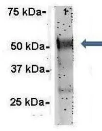 Anti-G3BP1 antibody, N-term used in Immunoprecipitation (IP). GTX47440