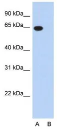 Anti-G3BP1 antibody used in Western Blot (WB). GTX47441