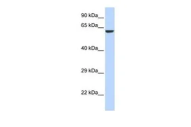 Anti-KCNV1 antibody, N-term used in Western Blot (WB). GTX47444