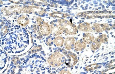 Anti-KCNAB2 antibody, Internal used in IHC (Paraffin sections) (IHC-P). GTX47447