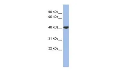 Anti-Connexin 40.1 antibody, Internal used in Western Blot (WB). GTX47477