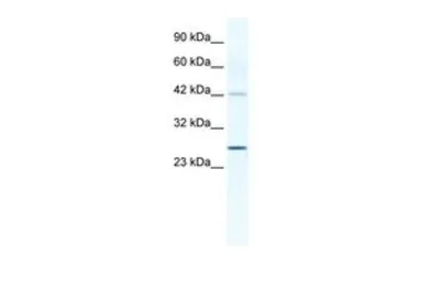 Anti-GJB4 antibody, Internal used in Western Blot (WB). GTX47479