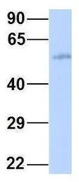 Anti-GJA9 antibody, Internal used in Western Blot (WB). GTX47481