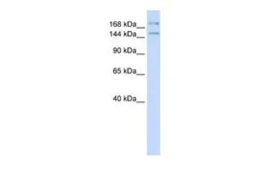 Anti-IFT140 antibody, N-term used in Western Blot (WB). GTX47485