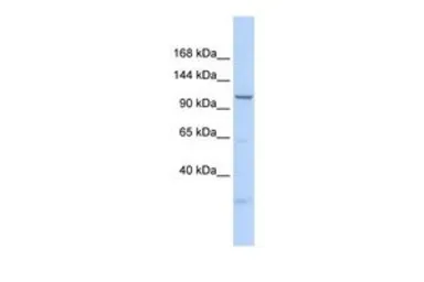 Anti-SKIV2L2 antibody, N-term used in Western Blot (WB). GTX47512