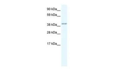 Anti-AKAP7 antibody, Internal used in Western Blot (WB). GTX47528