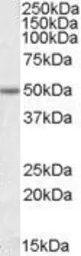 Anti-EVL antibody, Internal used in Western Blot (WB). GTX47560