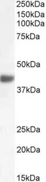 Anti-FBXO32 antibody, Internal used in Western Blot (WB). GTX47565