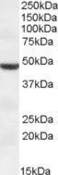 Anti-TMPRSS4 (aa245-57) antibody, Internal used in Western Blot (WB). GTX47593