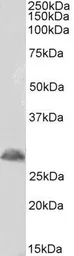 Anti-TREM2 antibody, Internal used in Western Blot (WB). GTX47596