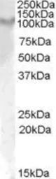 Anti-IL17 Receptor alpha antibody, Internal used in Western Blot (WB). GTX47598