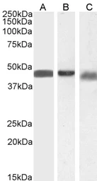 Anti-Beta Arrestin 2 antibody, Internal used in Western Blot (WB). GTX47600