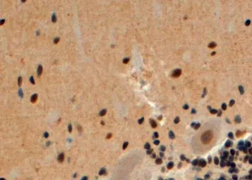 Anti-Beta Arrestin 2 antibody, Internal used in IHC (Paraffin sections) (IHC-P). GTX47600