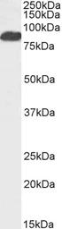 Anti-FOXP2 antibody, C-term used in Western Blot (WB). GTX47606