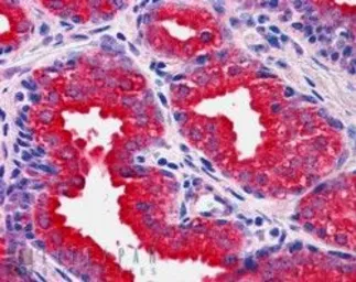 Anti-DUSP1 antibody, C-term used in IHC (Paraffin sections) (IHC-P). GTX47608