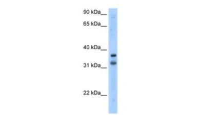 Anti-KCNRG antibody, N-term used in Western Blot (WB). GTX47611