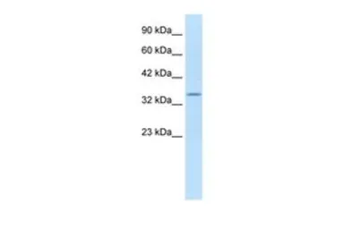Anti-KCNAB2 antibody, C-term used in Western Blot (WB). GTX47628