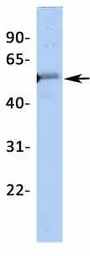 Anti-Kir2.2 antibody, Internal used in Western Blot (WB). GTX47662