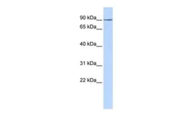 Anti-KCTD3 antibody, Internal used in Western Blot (WB). GTX47675