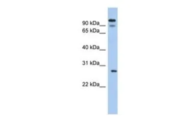 Anti-VDAC3 antibody, N-term used in Western Blot (WB). GTX47682