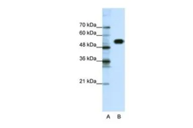 Anti-CLCNKB antibody, N-term used in Western Blot (WB). GTX47709