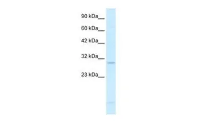 Anti-RALY antibody, N-term used in Western Blot (WB). GTX47714