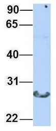 Anti-CTRL antibody, N-term used in Western Blot (WB). GTX47741
