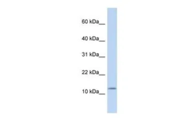 Anti-Cholecystokinin antibody, Internal used in Western Blot (WB). GTX47744