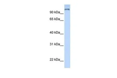 Anti-PARP9 antibody, N-term used in Western Blot (WB). GTX47754