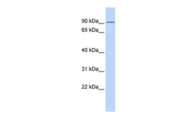 Anti-TIPARP antibody, N-term used in Western Blot (WB). GTX47758