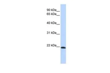 Anti-Claudin 7 antibody, Internal used in Western Blot (WB). GTX47766