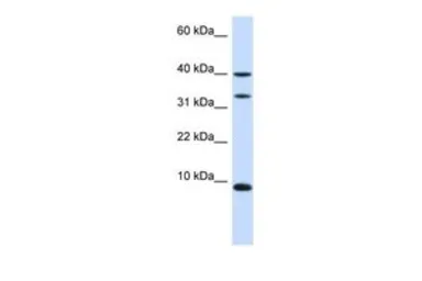 Anti-DBI antibody, N-term used in Western Blot (WB). GTX47770