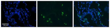 Anti-Ribonuclease T2 antibody, Internal used in IHC (Paraffin sections) (IHC-P). GTX47771