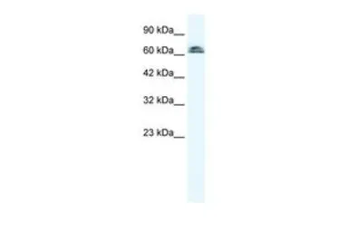 Anti-IVNS1ABP antibody, N-term used in Western Blot (WB). GTX47777