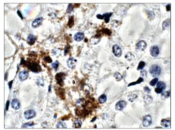 Anti-CTGF antibody used in IHC (Paraffin sections) (IHC-P). GTX47807