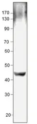 Anti-CTGF antibody used in Western Blot (WB). GTX47807