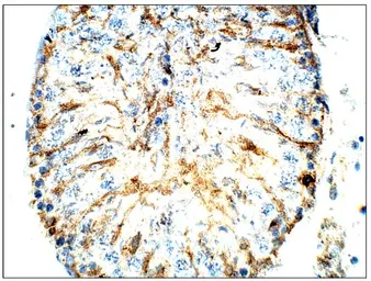 Anti-CD317 antibody (C-terminal) used in IHC (Paraffin sections) (IHC-P). GTX47811