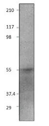 Anti-E2F2 antibody used in Western Blot (WB). GTX47813