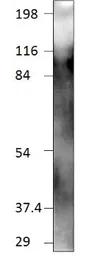 Anti-TMEM16A antibody used in Western Blot (WB). GTX47816
