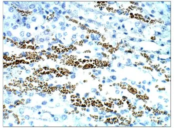 Anti-STRA6 antibody used in IHC (Paraffin sections) (IHC-P). GTX47858