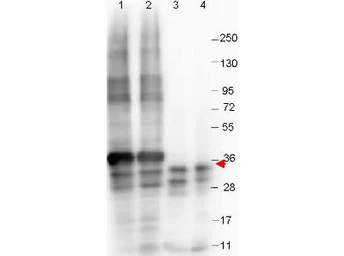Anti-GDF15 antibody [23G10.F8] used in Western Blot (WB). GTX48497