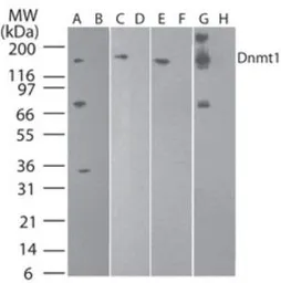 Anti-DNMT1 antibody [60B1220.1] used in Western Blot (WB). GTX48548