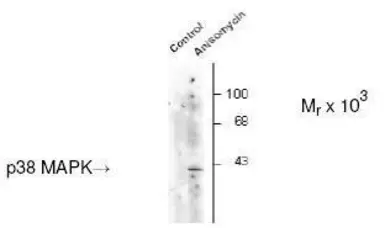 Anti-p38 MAPK (phospho Thr180/Tyr182) antibody used in Western Blot (WB). GTX48614