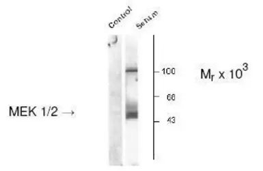 Anti-MEK1 (phospho Ser217) + MEK2 (phospho Ser221) antibody used in Western Blot (WB). GTX48615