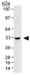 Anti-beta Tubulin antibody used in Western Blot (WB). GTX48617