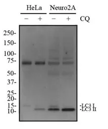 Anti-LC3A antibody used in Western Blot (WB). GTX48634
