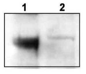 Anti-Trkct1 antibody used in Western Blot (WB). GTX48720