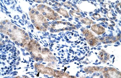 Anti-CLIC1 antibody, N-term used in IHC (Paraffin sections) (IHC-P). GTX48722